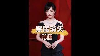 一張高清照曝光，揭開孫儷「黑痣」消失的真相，果然不是我們想的這麼簡單 #孫儷 #娛樂資訊 #明星八卦 #內容啟發搜索  #娛樂評論大賞