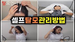 [Eng_Sub] I Treat My Own Hair Loss! #1: Introduction to Hair Loss Prevention Routine