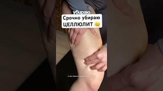Убираю целлюлит Напомню, что едва заметные при сжатии кожи бугорки - норма УЗ | #целлюлит #уход