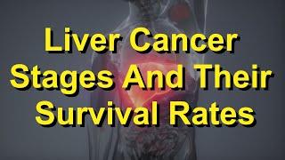 Liver Cancer Stages And Their Survival Rates