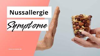 Nussallergie: Diese Symptome sind möglich