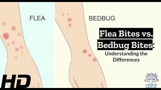 Bug Bite Showdown: Identifying Flea vs. Bedbug Bites