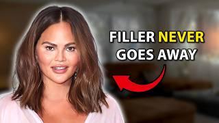 The Scary Truth About Filler | Plastic Surgeon Reacts