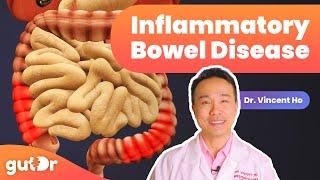Inflammatory Bowel Disease (IBD) | The GutDr Explains (3D Gut Animation)