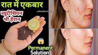 कितनी भी पुरानी झाइयां, Pigmentation जड़ से खत्म करें 100% रिजल्ट || How To Remove Pigmentation