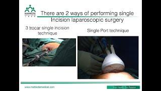 The Challenges of Adapting Single Port Laparoscopic Surgery into Laparoscopic Practice
