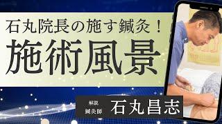 石丸院長による鍼灸施術風景＠町田本院【東洋医学専門の鍼灸院】