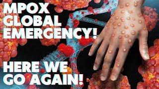 MPOX DECLARED A GLOBAL EMERGENCY - Get Ready For New Lockdowns & Vaccines ?