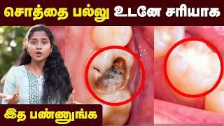 Teeth Care: இத செஞ்சா உங்க பல் நட்சத்திரமா மின்னும்|பல் சொத்தை வராமல் இருக்கணுமா| Doctor Advice