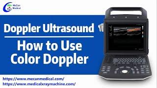 Doppler Ultrasound | Live Demonstrate How to Use Color Doppler | MeCan Medical