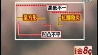 台中菲仕美診所整形外科林孟羲醫師 雙面複合式隆乳DEPEEM東森新聞 WMV 360p