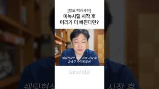 미녹시딜 시작 후 머리가 더 빠진다? 쉐딩 현상 고민이라면 필수시청!