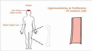 Acute Leukemia - Part 1