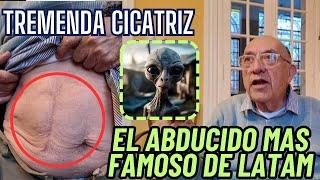 El caso de CARLOS DIAZ, el ABDUCIDO mas FAMOSO de LATINOAMERICA. Los ALIENS le dejaron GRAN CICATRIZ