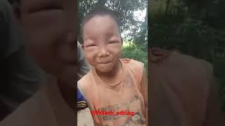 Borole kamurile kela||see a small Assamese kid bitten by a bee funny moment