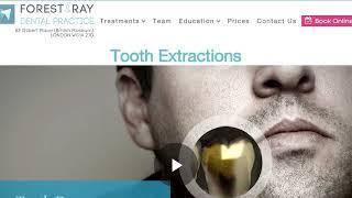 Tooth Extraction W1 Holborn Camden London - Forest & Ray - Dentists, Orthodontists, Implant Surgeons