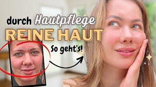 ‍️Mit Hautpflege UNREINE HAUT loswerden