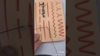 Suture Technique: Horizontal Mattress