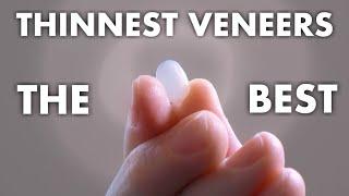 The BEST veneers you can get! | (2022) Atlanta Dental Spa