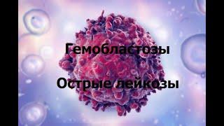 острый лейкоз ОЛ : патогенез, клинические проявления, гемограмма