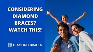 Diamond Braces. What you need to know if you consider to see them.