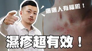 濕疹、汗皰疹好不了！？簡單幾招還你美麗好皮膚！癢癢必學！【77老大】