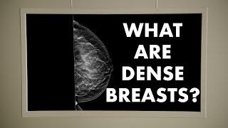 What are Dense Breasts?