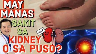 May Manas: Sakit Ba Sa Kidney O Sa Puso - Payo ni Doc Willie Ong