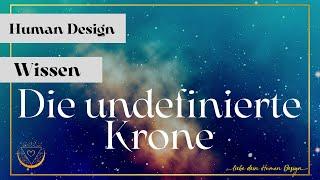 Das Leben mit undefinierter Krone: Das musst du wissen!