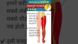 Sciatica Ka Dard #shorts #physiodrdeepaksoni