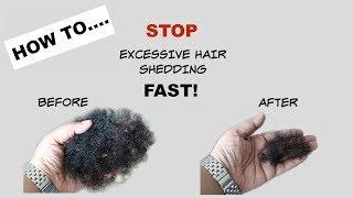 STOP Excessive Hair Shedding Fast | Tea Rinse | Natural Hair