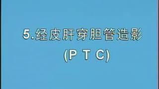 卫生部医学视听教材—消化内科—XHN004 经皮胆道引流术