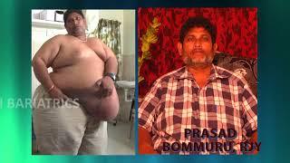 best bariatric surgery results by Dr Ravikanth kongara Hyderabad Vijayawada