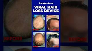 2024 Hair Loss Device - Is It Legit?