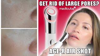 HOW TO GET RID OF LARGE PORES | MEDICUBE AGE-R ATS AIR SHOT W BEFORE & AFTERS