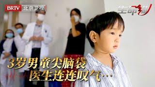 3岁男孩从出生脑袋就是尖的，医生感叹无力回天，治疗太晚恐一辈子大脑残缺，要想根治只能打碎所有骨头……【生命缘第12季】