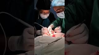 Lip Reduction surgery Bangladesh | Lip surgery Bangladesh  | Lip reshaping | Lip filler  01314099922