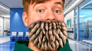 ASMR Mr Beast Mouth Care Treatment | ASMR Muh Ka Elaj Upchar |