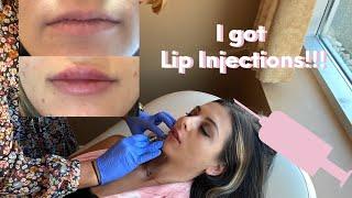 Lip Injections 