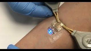 Carmel Majidi: Electronic Tattoos for Wearable Computing: Stretchable, Robust, and Inexpensive