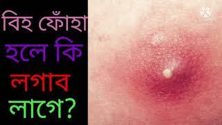 বিহ ফোঁহা হলে কি লগাব লাগে?বিহ ফোঁহাৰ ঘৰুৱা উপায়?#Akhomiatgharuadihabychandrakala.