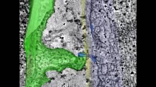 Part of the scar tissue (green) connects with the healthy tissue (blue) in a mouse’s heart.