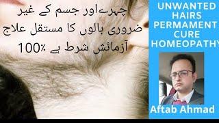 Unwanted Facial Hairs Treatment in homeopathy, Hirsutism cure, oleum jack 3x