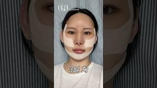 윤곽수술을 결심한 이유 #shorts