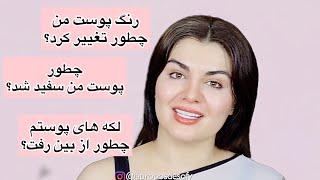 پاسخ به سوالهای شما در مورد تغییر پوست من قلیه میگو هم‌درست میکنیم