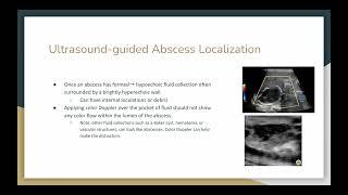 Introduction to Ultrasound Guided Procedures
