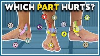 My ankle hurts here! 11 typical pain spots and what they mean