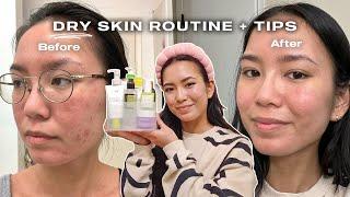 dry, sensitive, acne-prone skincare routine w/ tips (not sponsored)