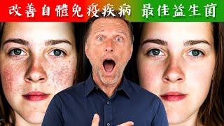 改善自體免疫病,最佳益生菌,自然療法,柏格醫生 Dr Berg