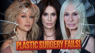 10 Shocking Celebrity Plastic Surgery Fails You Won’t Believe!